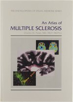 An Atlas of Multiple Sclerosis