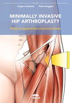 Minimally Invasive Hip Arthroplasty