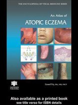 An Atlas of Atopic Eczema