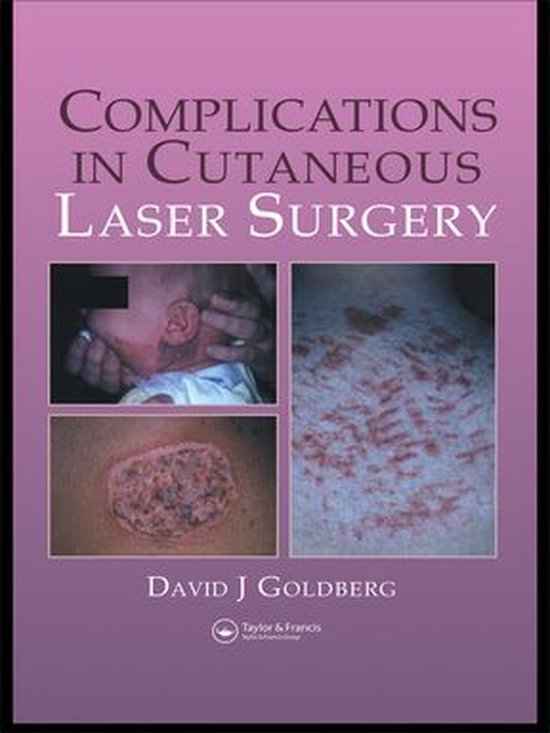 Complications in Laser Cutaneous Surgery - cover
