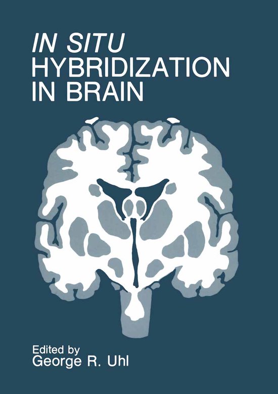 Foto: In situ hybridization in brain