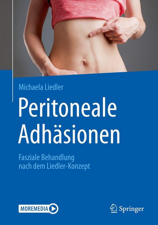 Medicine (German Language) - Peritoneale Adhäsionen - cover