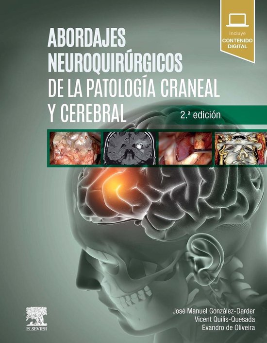 Abordajes neuroquirúrgicos de la patología craneal y cereb ... - cover