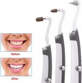 LOUZIR Elektrische Tandsteen/Tandplak  Verwijderaar- 3 opzetstukken - tandenplijsten - tandenbleker - flosapparaat