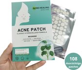 acne patch- pimple patch- puisten verwijdereraar-persoonlijke verzorging- gezichtsmaskers en strips-huidverzorging- beauty- acne sticker- acne pleister- puisten pleister- acneverzorging- gezondheid-108 stuks