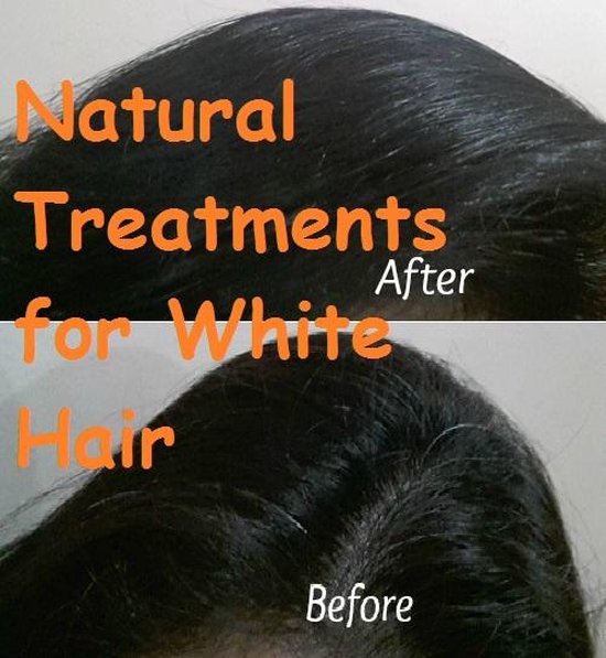 VT - Natural Treatments for White Hair - cover