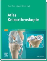 Atlas Kniearthroskopie
