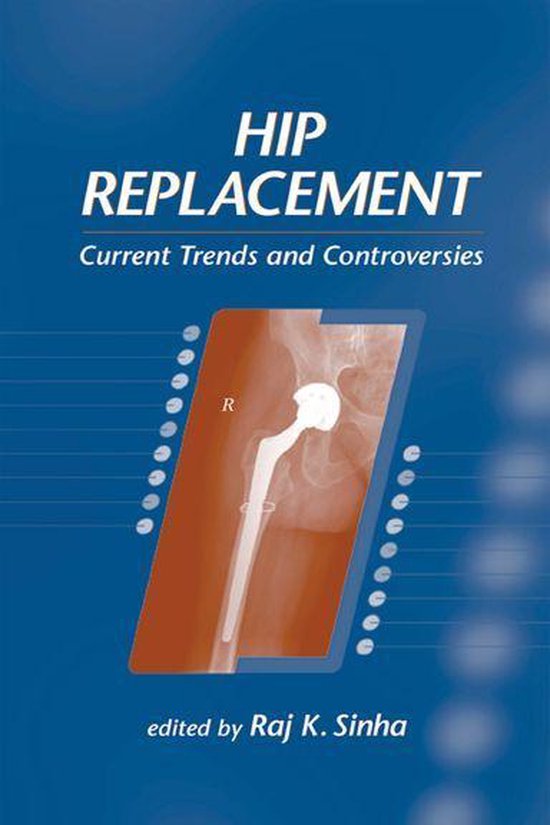 Hip Replacement - cover