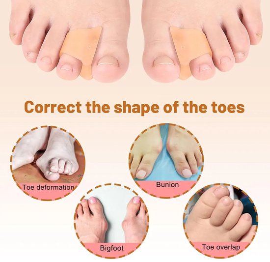 12-delige set voor de correctie van hamerteen, teenscheider, teencorrector, gel teenspalk, ter verlichting van hallux valgus, hamerteen, gebogen teen, klauwteen. van SKIEHAN — afbeelding 5