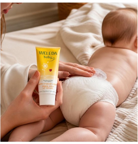 Moeder brengt Weleda billenbalsem aan op babybilletjes met luier.
