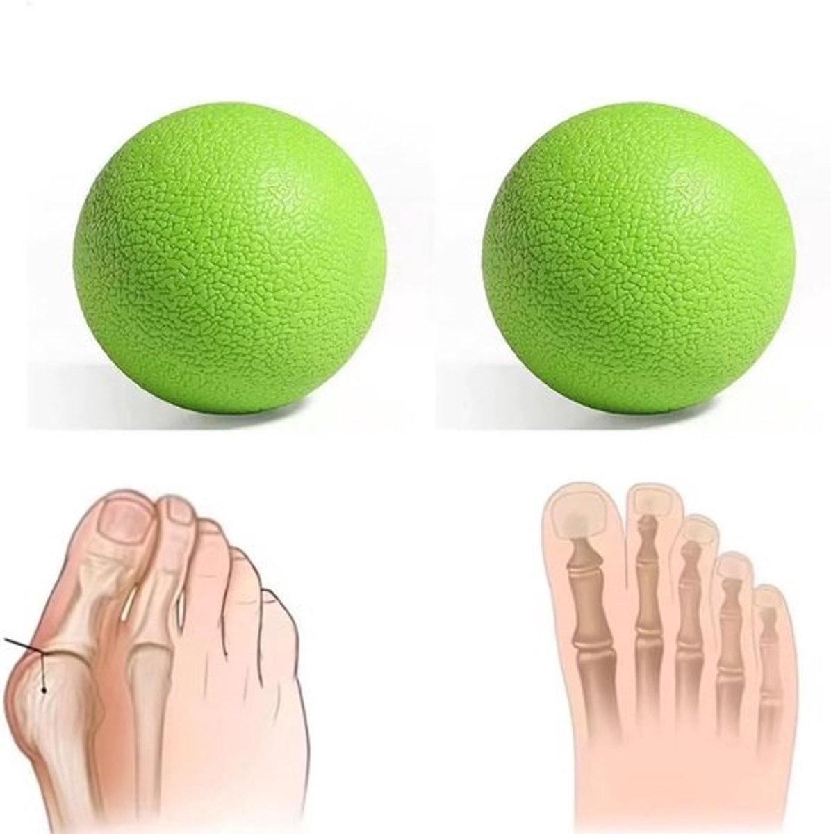 Voetmassagebal - Myofasciale bal - Spierontspanning - Gerichte verlichting - 7x7x7 cm - Groen