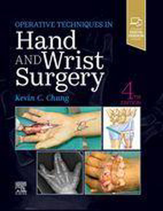 Operative Techniques - Operative Techniques: Hand and Wrist  ... - cover