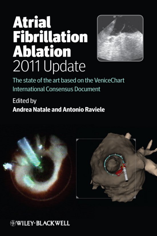 Foto: Atrial fibrillation ablation 2011 update