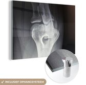 MuchoWow® Glasschilderij 150x100 cm - Schilderij acrylglas - Een röntgenfoto van de patella - Foto op glas - Schilderijen