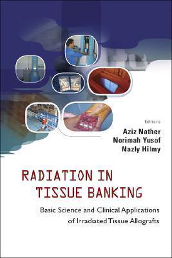 Radiation In Tissue Banking 9789812705907 Aziz Nather Boeken