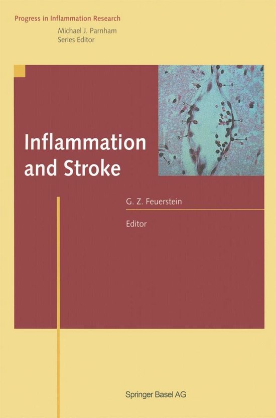 Progress In Inflammation Research Inflammation And Stroke Ebook Giora Z Bol Com