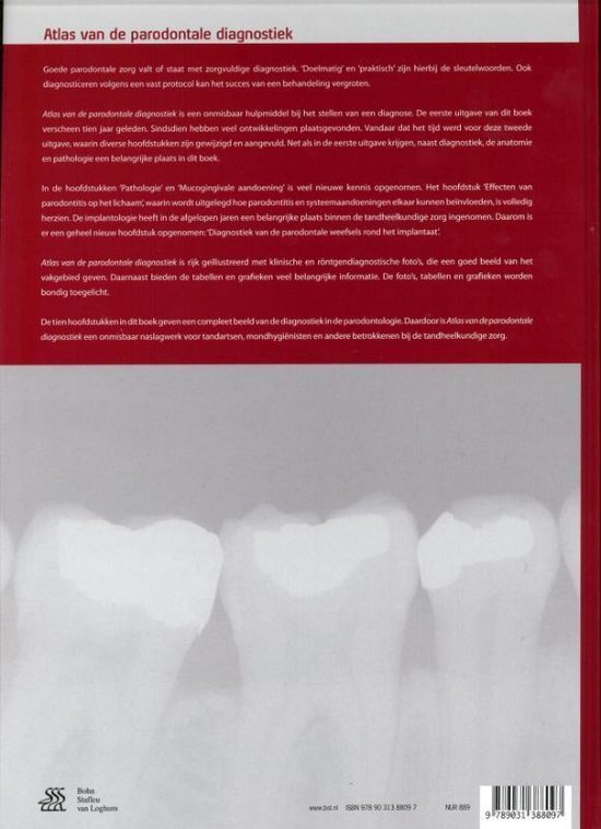 Bol Com Atlas Van De Parodontale Diagnostiek 9789031388097 Fred Spijkervet Boeken