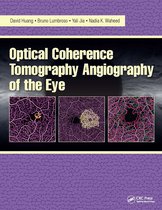 Optical Coherence Tomography Angiography of the Eye