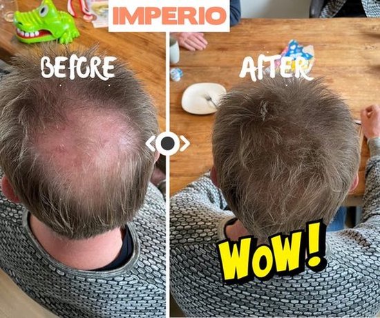 Voor en na foto's van het hoofd van een man, met de tekst "WOW!". IMPERIO haarvezels maken het haar voller.