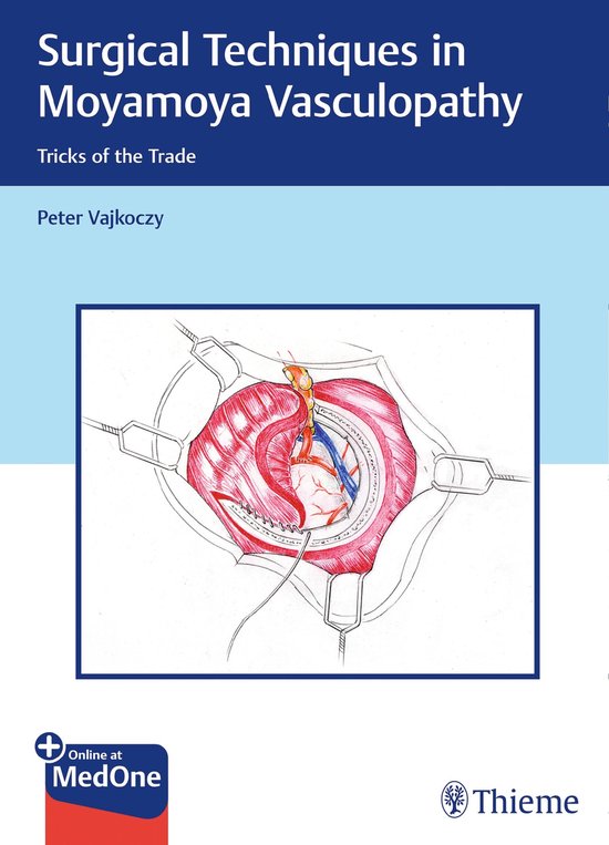Surgical Techniques in Moyamoya Vasculopathy - cover
