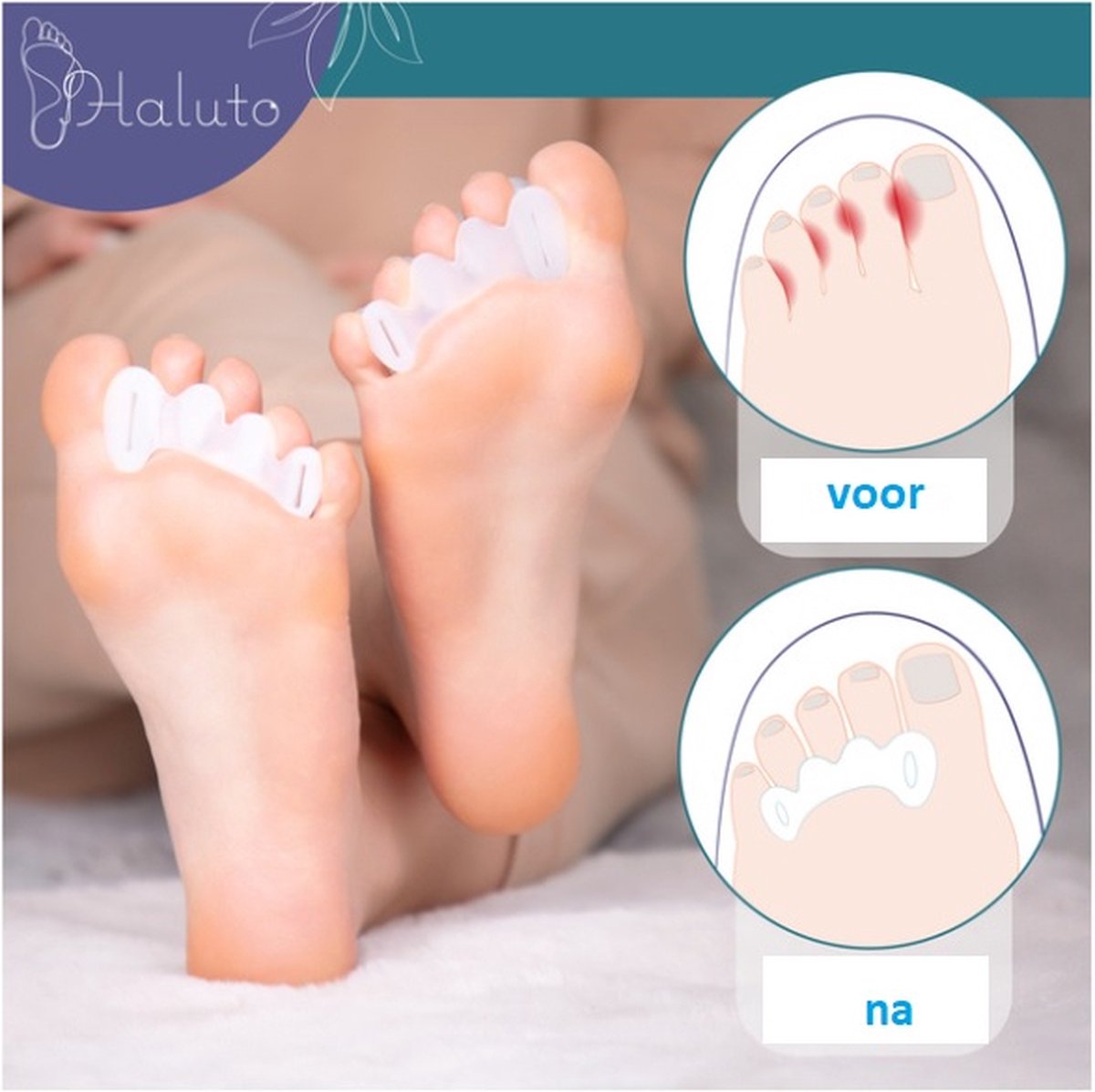 Goedkoopste Gel separator overlays corrigeren hallux valgus en overlappende tenen - Ideaal voor gebruik bij hallux valgus en hamerteenproblemen. Ze worden over drie tenen gedragen en bieden comfortabel dragen en ondersteuning. Maat L- lengte 9 cm, breedte 2,4 cm