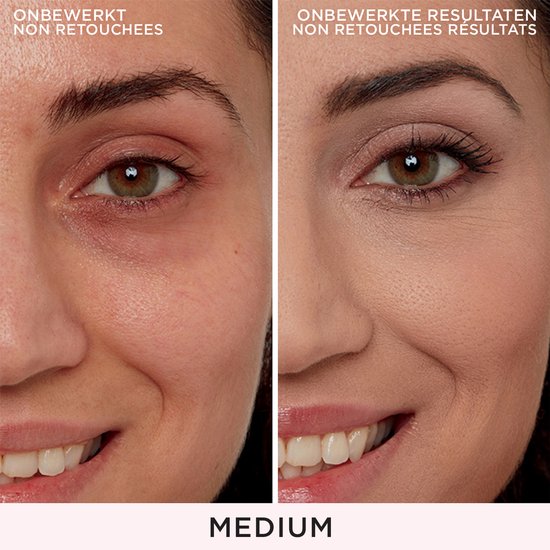 Vergelijking van de IT Cosmetics Bye Bye Under Eye concealer 'Medium'. Links: onbewerkte huid rond de ogen. Rechts: met concealer aangebrachte huid.