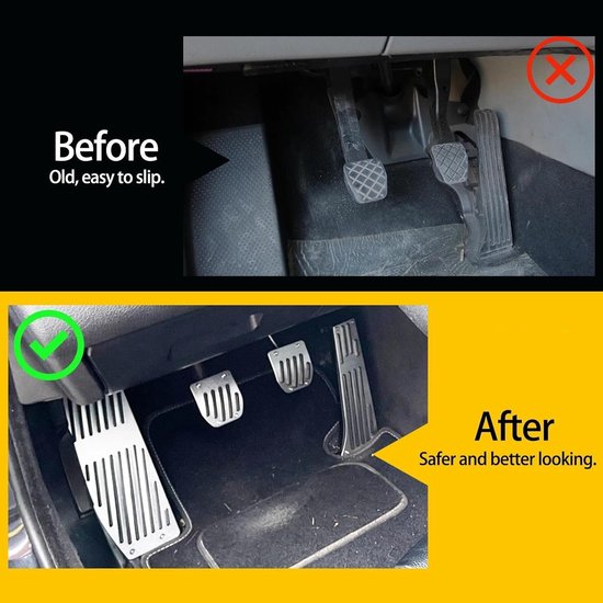 Pedaal Set - Auto Voetpedalen - Interieur Upgrade - Duurzame Legering Rubber - 3 of 4 Delig - MT — afbeelding 2