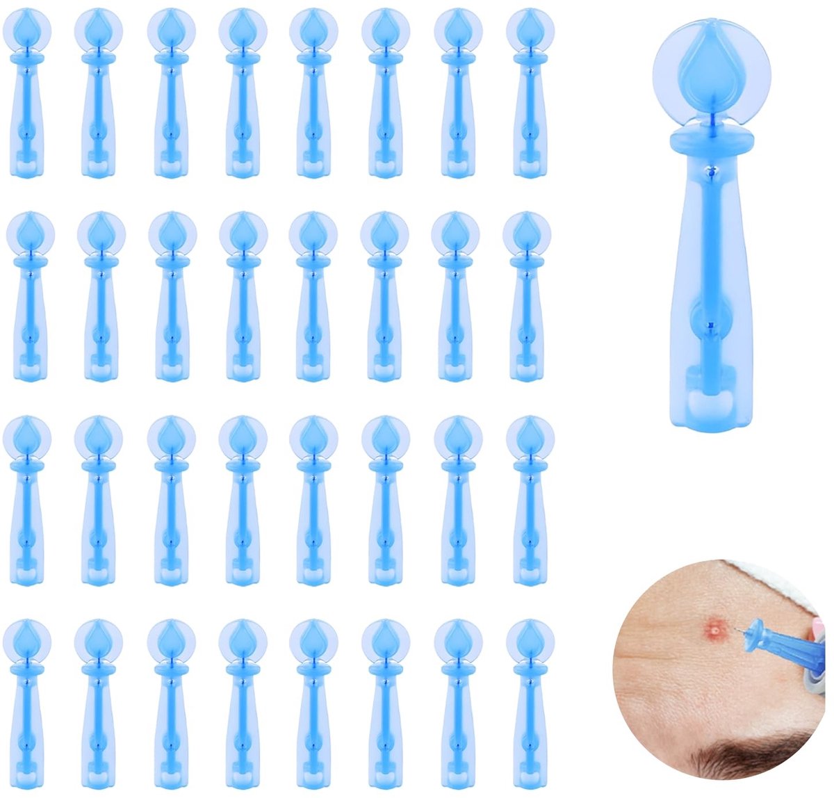 Dailygoods - Dailygoody - Mee-eter en onzuiverheid verwijderaar - Acne puistje popper set - 100 stuks - Voor een heldere huid - Professionele huidverzorging - Gesc