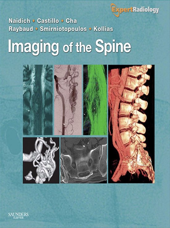 Imaging Of The Spine