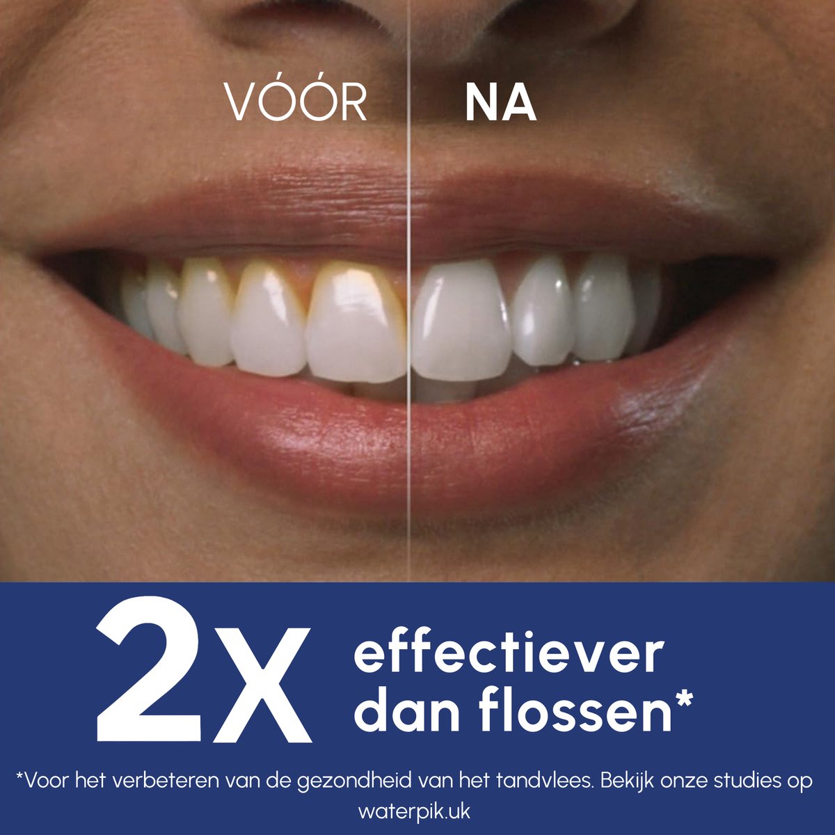 Waterpik Cordless Pearl draadloze elektrische waterflosser, oplaadbaar. Verwijdert tandplak, reinigt tussen tanden, waterdicht en ideaal voor reizen of kleine badkamers. Wit. thumbnail 2