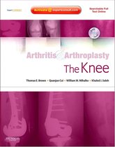 Arthritis and Arthroplasty: The Knee