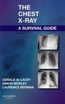 Chest X Ray Survival Guide