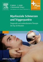 Myofasziale Schmerzen und Triggerpunkte