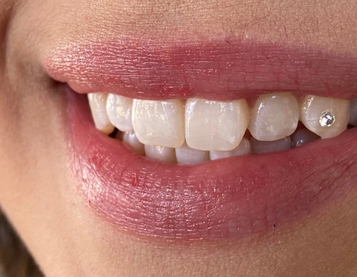 Tooth Gem Set Tooth Gem Kit met 139 x kristallen, doe-het-zelf handgemaakte tandsieraden voor het verfraaien en versieren van de tanden, ideaal voor Tooth Gem Set Tooth Gem Kit met 139 x kristallen, doe-het-zelf handgemaakte tandsieraden voor het verfraaien en versieren van de tanden, ideaal voor
