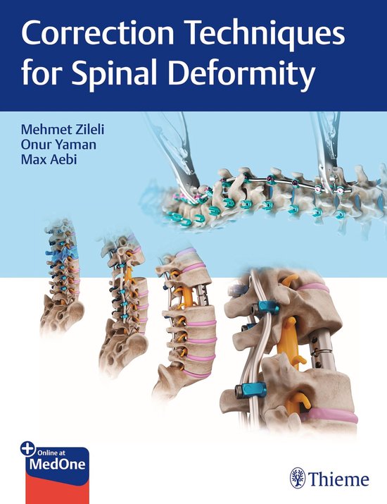 Correction Techniques for Spinal Deformity - cover