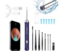 MetuX® Oorsmeerverwijderaar met Camera - Oorsmeer verwijderaar met Camera - Oorreiniger Oorsmeer – Ear Cleaner – Oren Schoonmaken – Oorspuit - Oorcamera – Oorlepel - Earscratcher - Ultra HD Camera - Inclusief reinigingsset - Lange batterij – Blauw