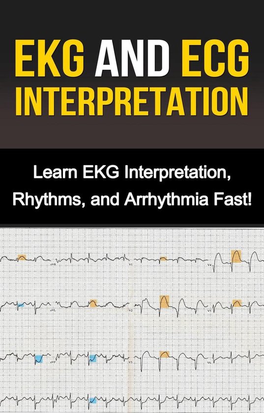 EKG and ECG Interpretation - cover