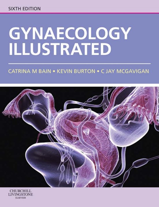 Gynaecology Illustrated E-Book - cover