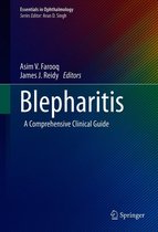 Essentials in Ophthalmology - Blepharitis