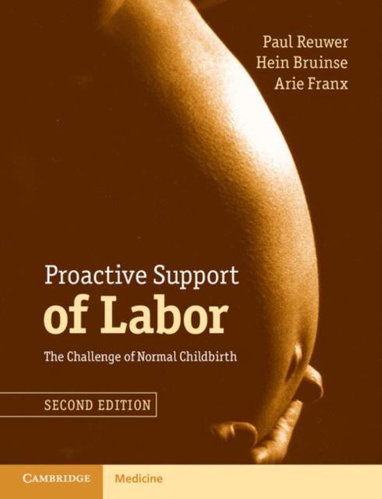 Proactive Support Of Labor