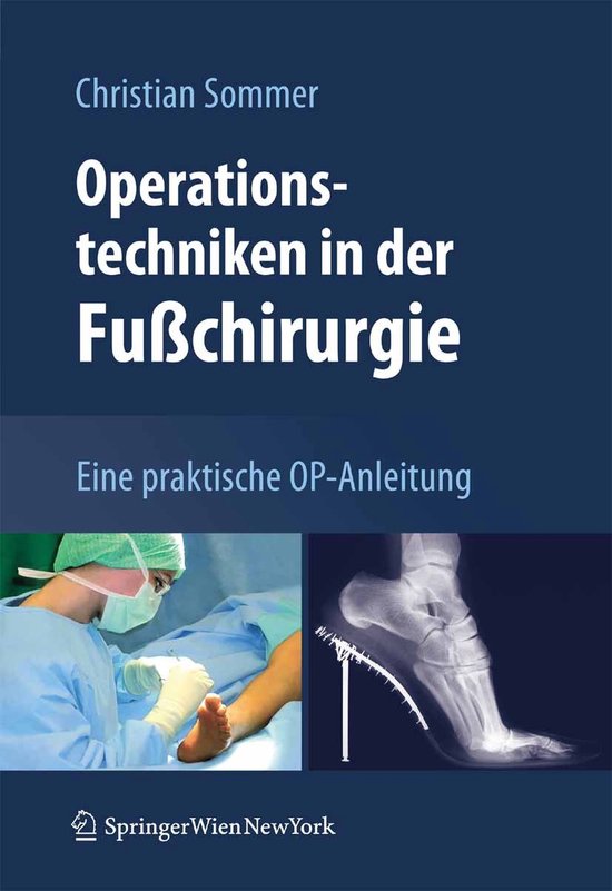 Foto: Operationstechniken in der fusschirurgie