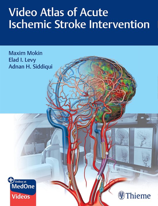 Video Atlas of Acute Ischemic Stroke Intervention - cover