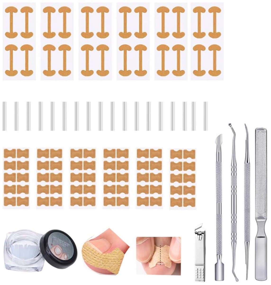 Set voor het Corrigeren van Ingegroeide Teennagels met Correctiestrips, Professionele set voor Ingegroeide Teennagels, Correctiepleister voor Gebogen Teennagels, voor Pedicure Thuis