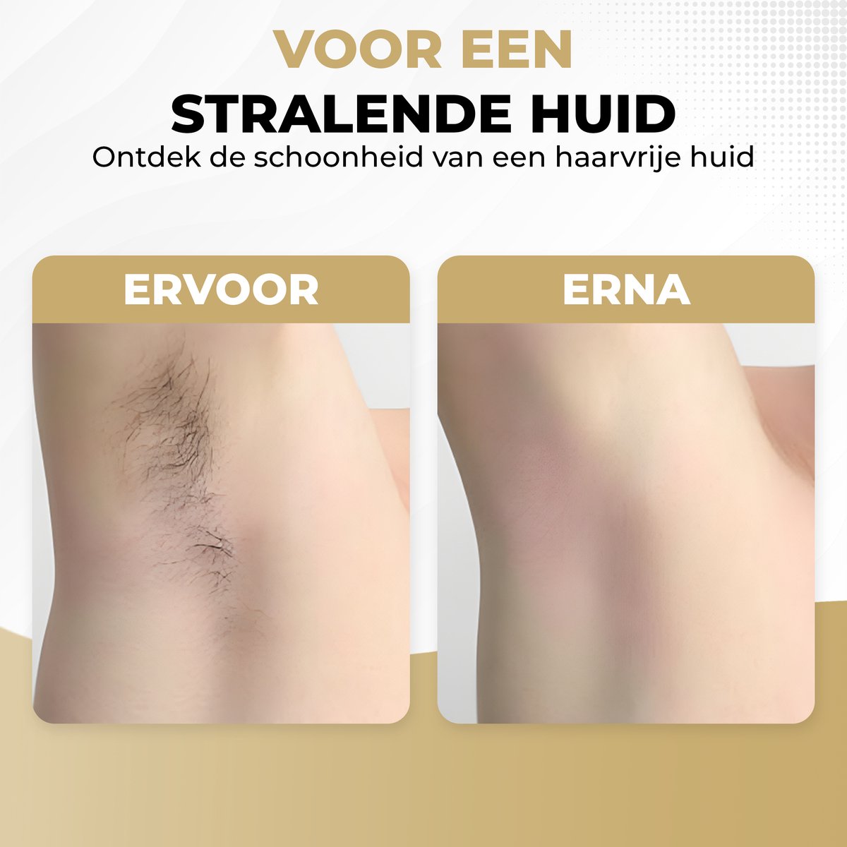 GoGoldPro® - IPL - Ontharingsapparaat - Lichtontharing - IPL ontharing - Zwart & Wit - 999.999 Flitsen + Gratis Zonnebril & Scheermes