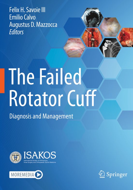 The Failed Rotator Cuff - cover