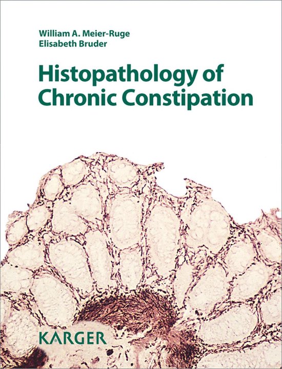 Histopathology of Chronic Constipation - cover
