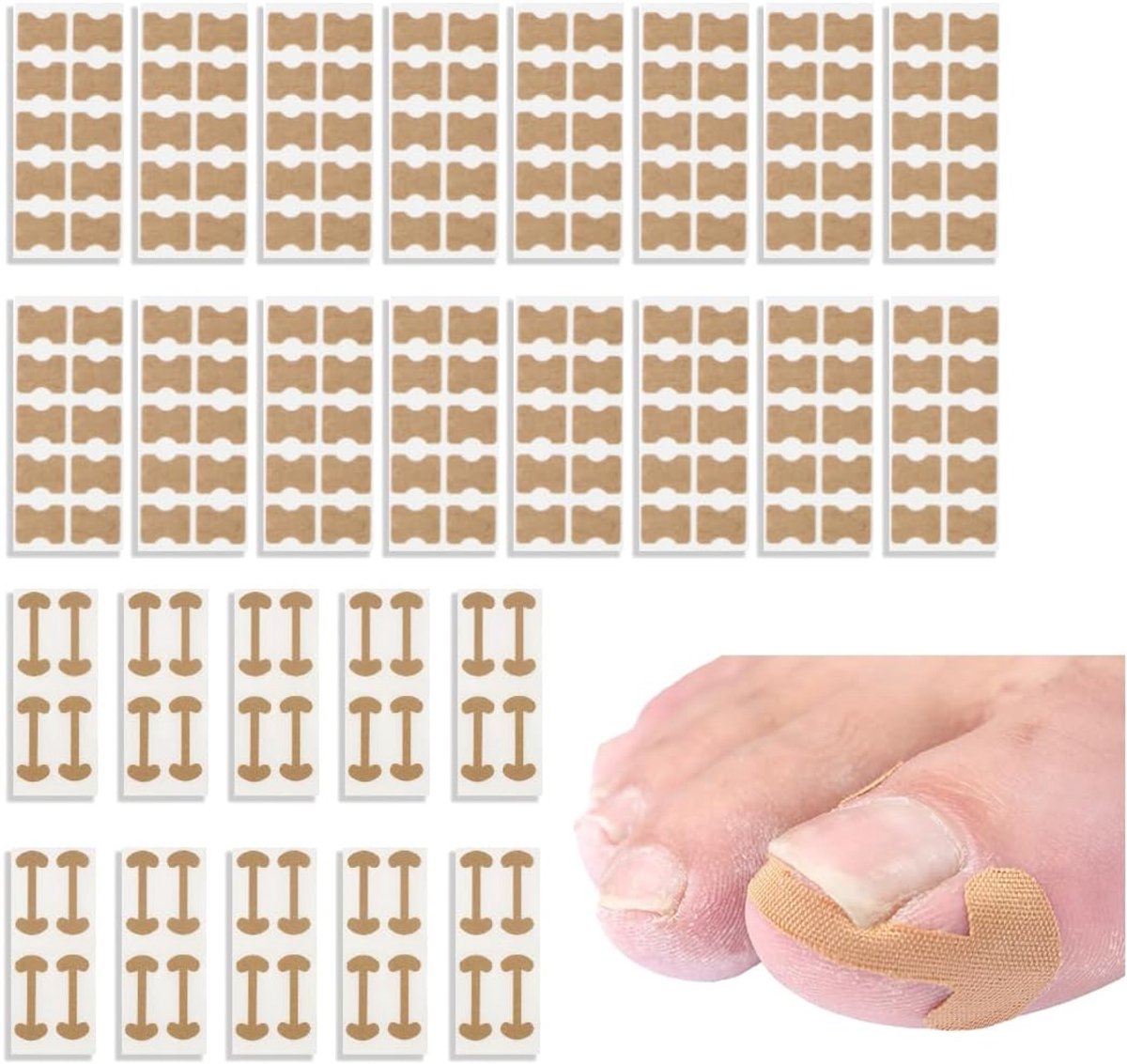 200 stuks ingegroeide teennagels, correctie-hulp voor teennagels, correctiehulp voor ingegroeide teennagels, nagelstickers, elastisch katoenen materiaal, eenvoudig te bedienen, ingegroeide