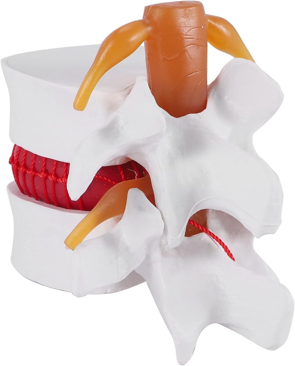 Demonstratiemodel van de menselijke anatomie voor lumbale hernia en wervelkolomstudie met 1:1.5 schaal