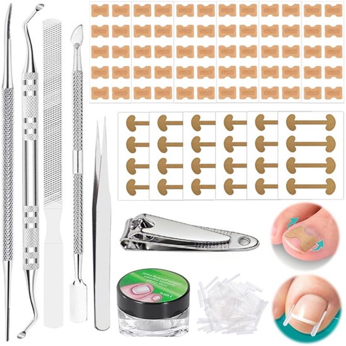 Teennagelset 139 Stuks - Teennagelcorrectieset - Ademend - Nagelverzorgingsstrips - Nagelknipper - Veiligheidswaarschuwing Ja - Nagelcorrectieset