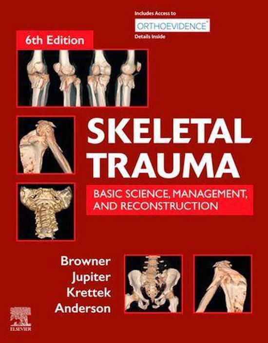 Skeletal Trauma E-Book - cover